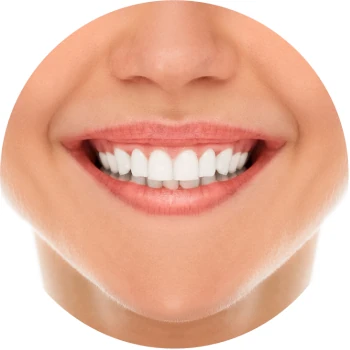 Professional Teeth Whitening Treatment at Bonita Laser in Mississauga